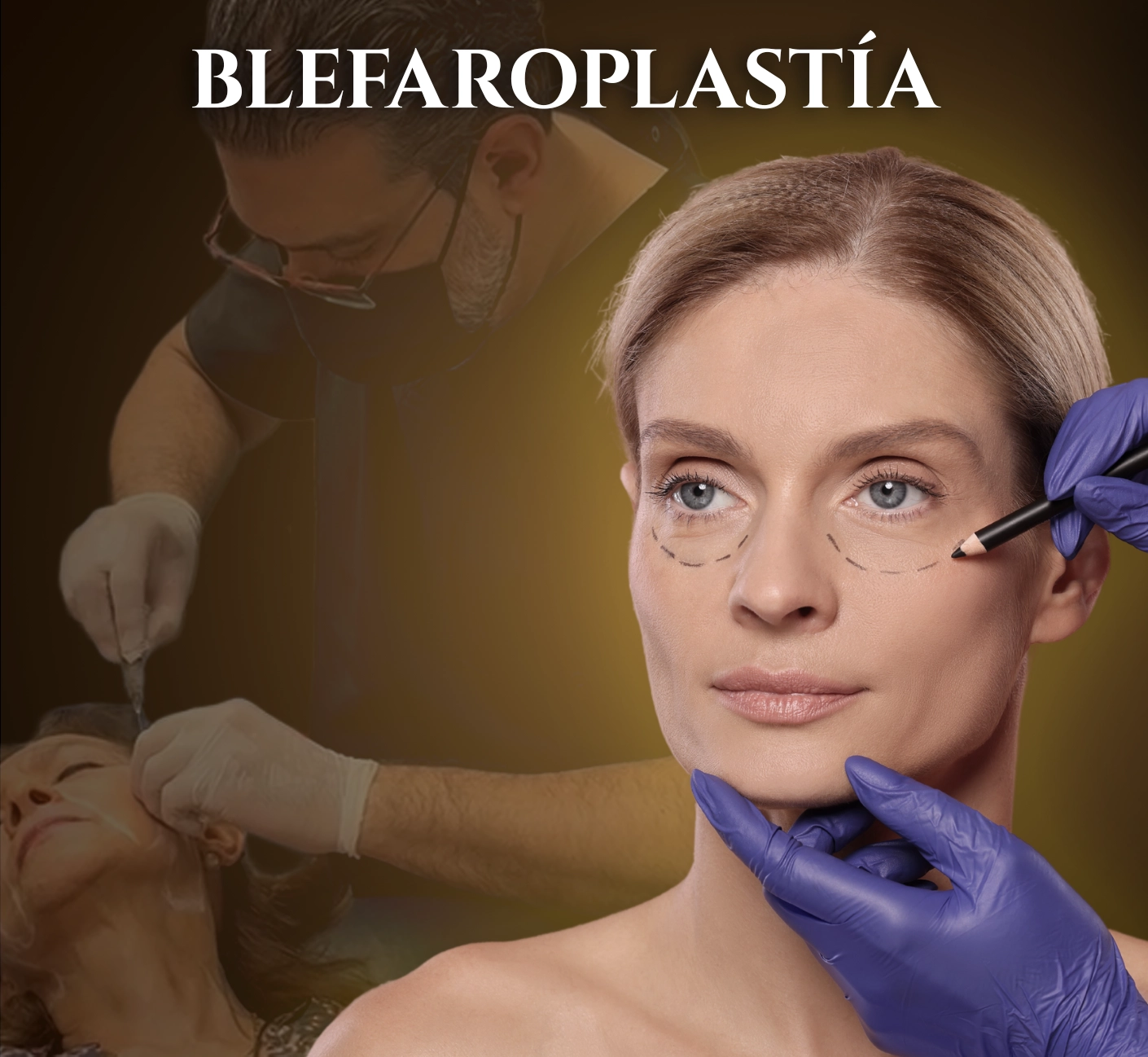 Blefaroplastia